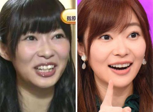 【2026年最新】指原莉乃の美の進化史――なぜ彼女の美的変化は時代を超えて日本中を魅了し続けるのか？