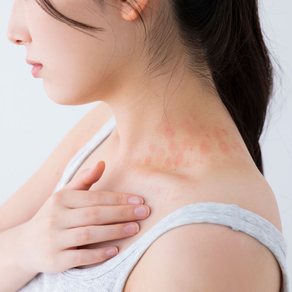 身体に赤い斑点が出る原因とは？痒みの有無で見分ける危険度と受診目安