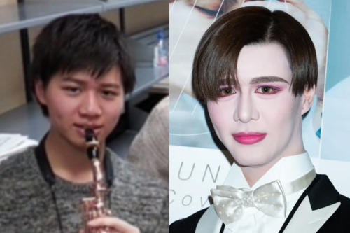 Mattの元の顔は別人級？加工なしの素顔と劇的変化の真相を徹底解説