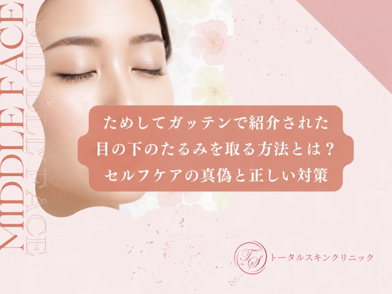 ためしてガッテン「目の下のたるみ取り」の真相と2026年最新改善策