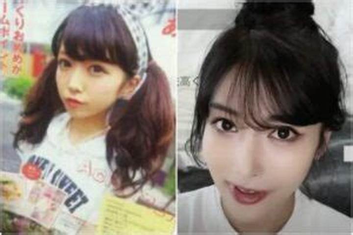 Rちゃん整形前の顔とは？真相と噂を徹底検証